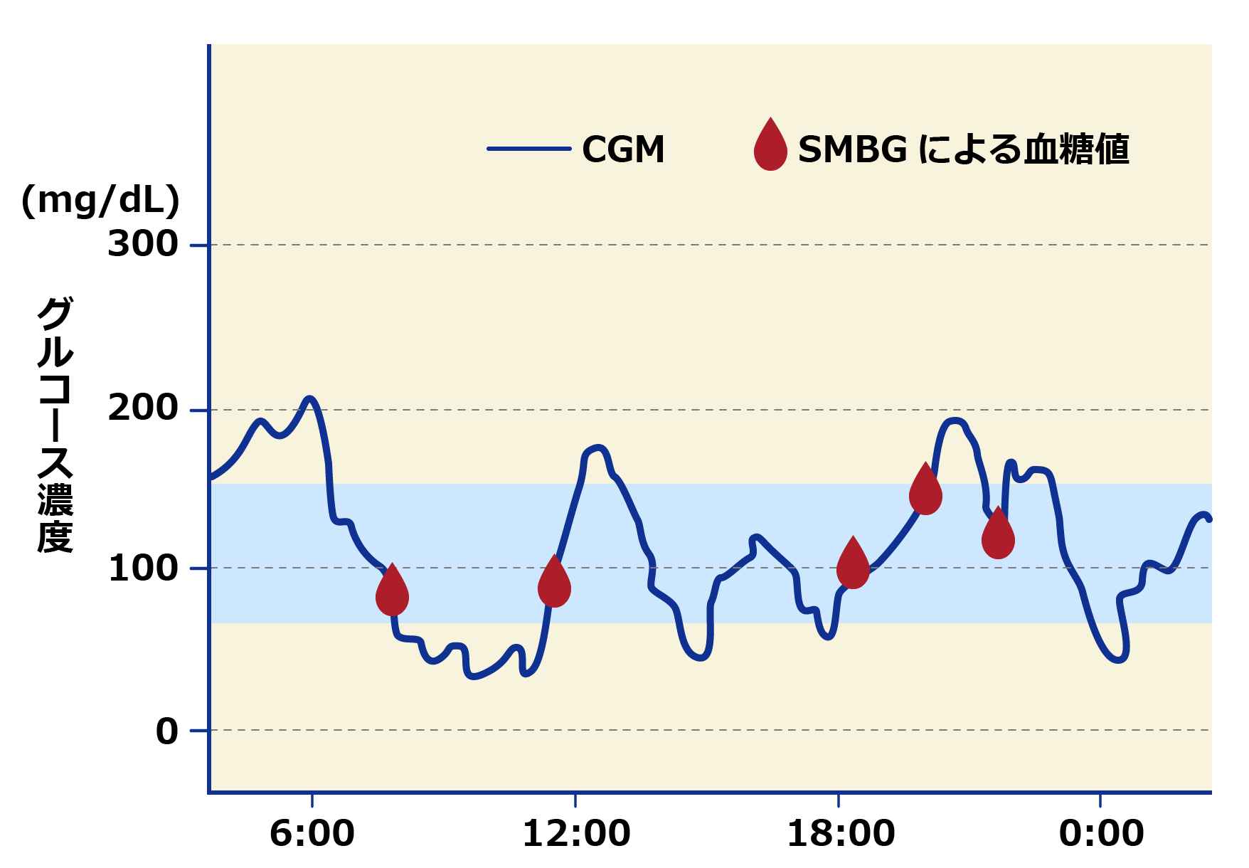 持続血糖モニターによる日内変動パターン