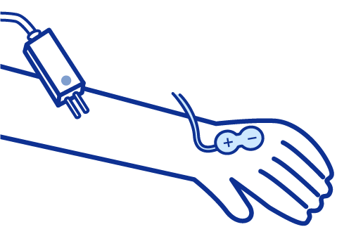 末梢神経伝導検査