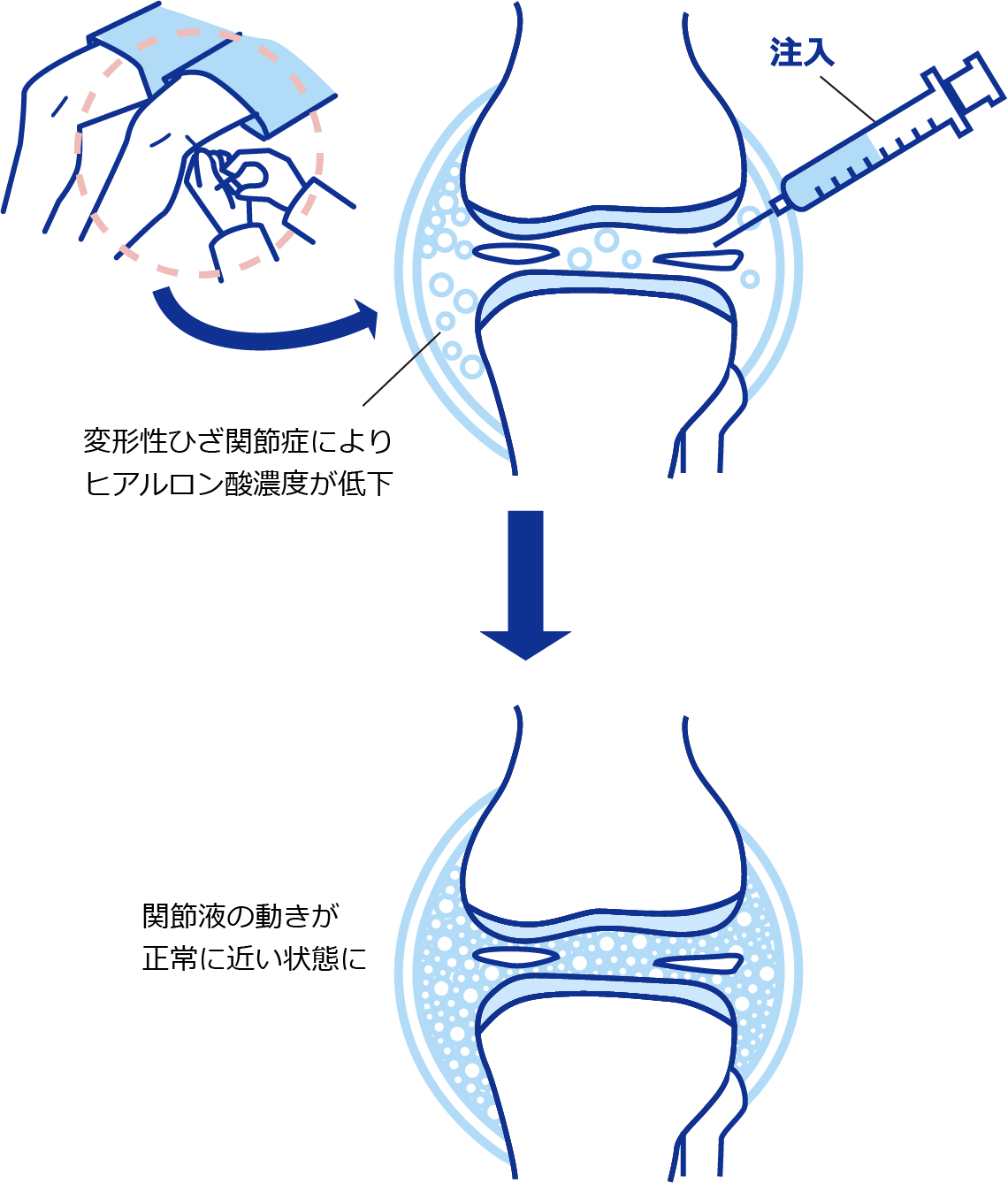股関節の動きが滑らかになる