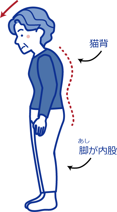 猫背、脚が内股
