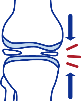 関節のすき間が狭くなり始める