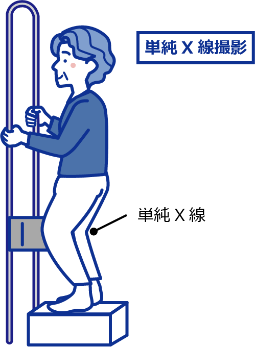 単純x線撮影