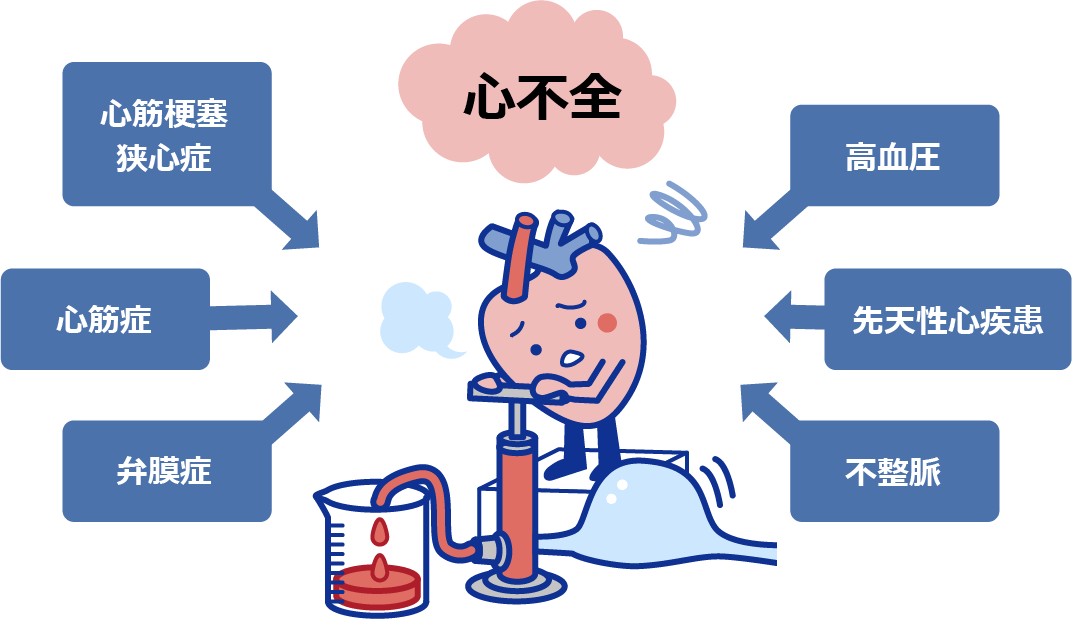 心筋梗塞、高血圧、狭心症、心筋症、不整脈など