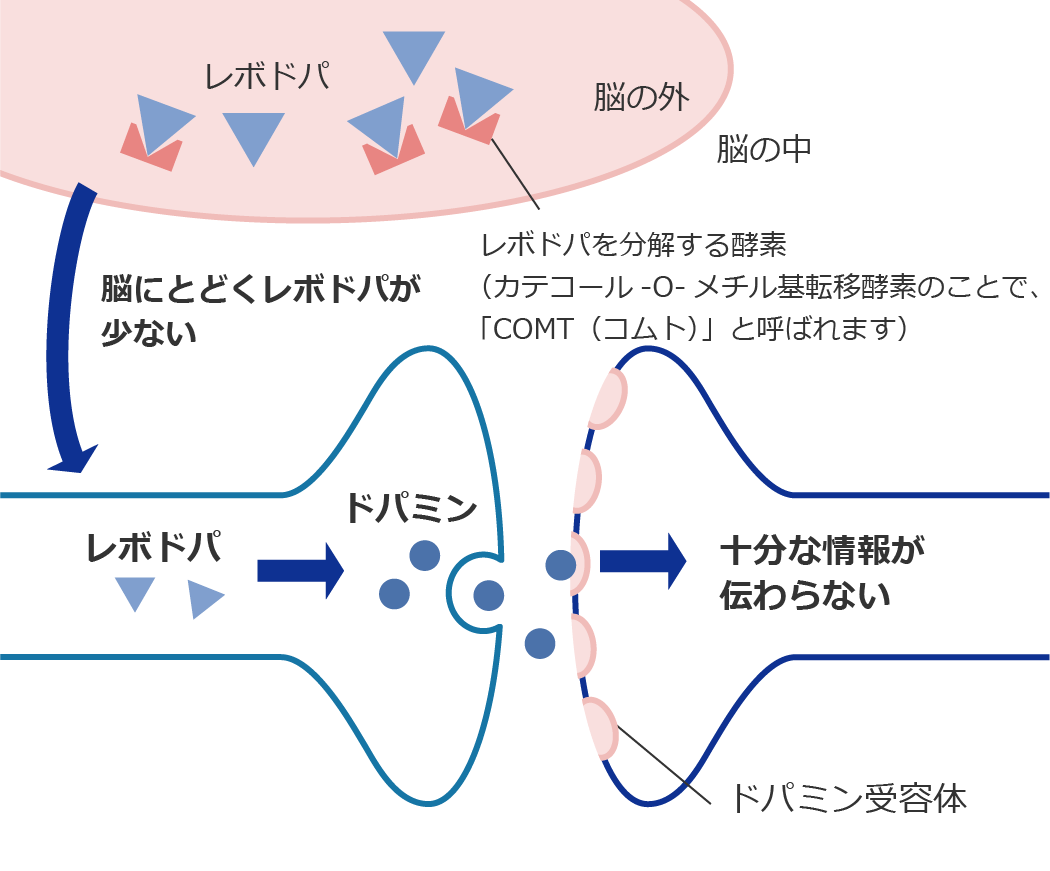 レボドパが分解されて、ドパミンが十分に増えない