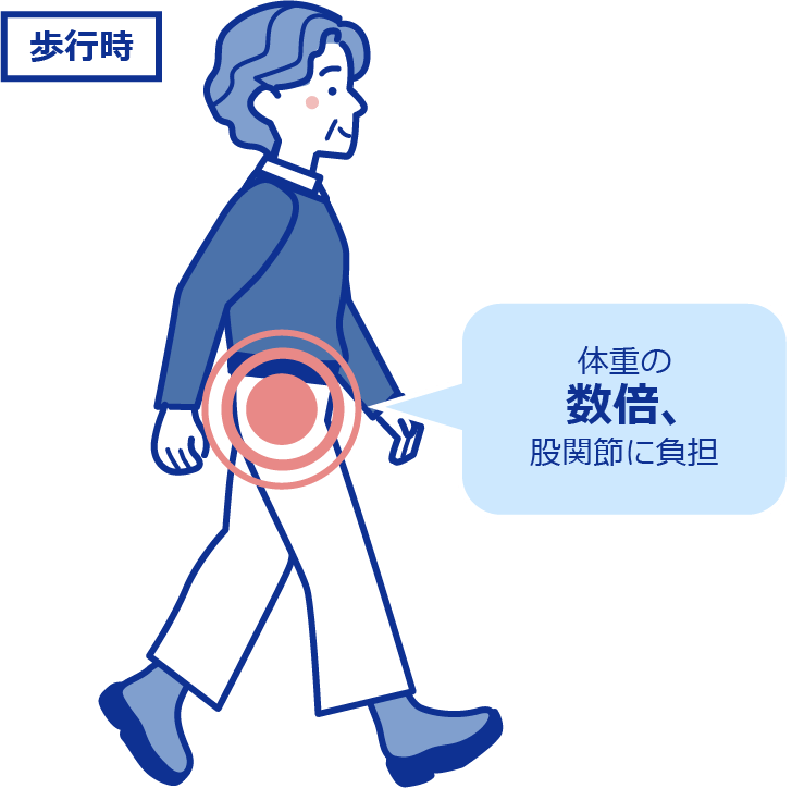 歩行時は体重の数倍、股関節に負担がかかる