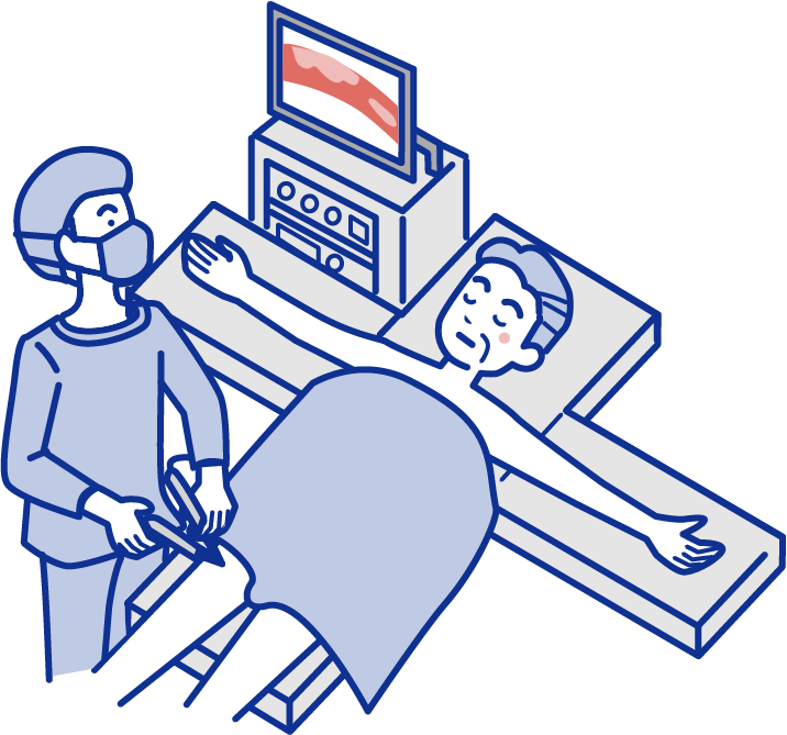 関節鏡視下手術のイラスト