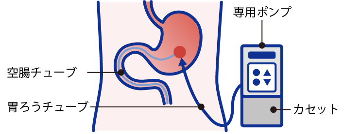 専用ポンプとチューブ
